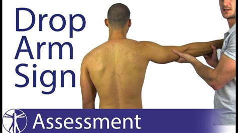 drop test shoulder exam|positive drop arm sign.